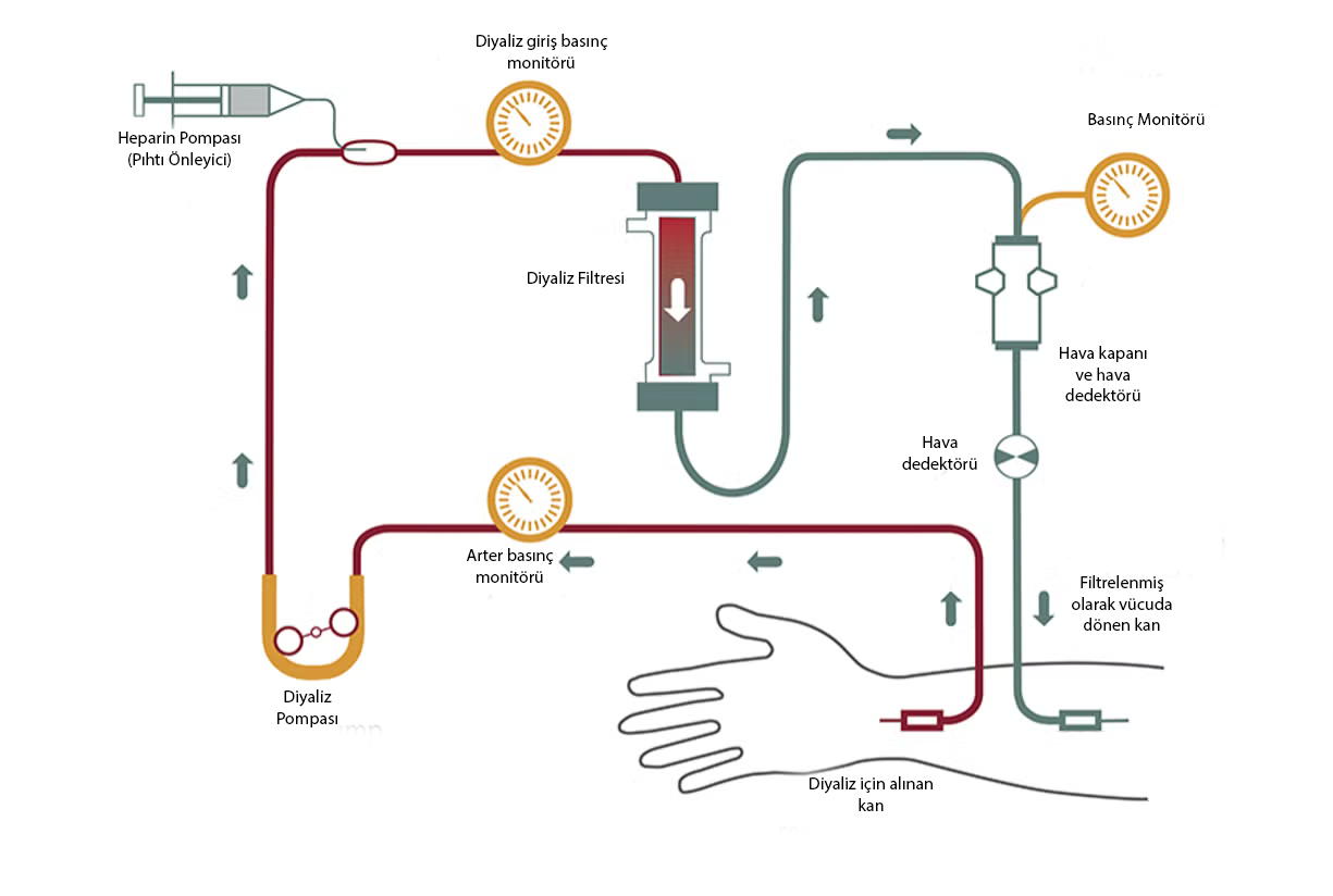 Hemodiyaliz İşlem Döngüsü
